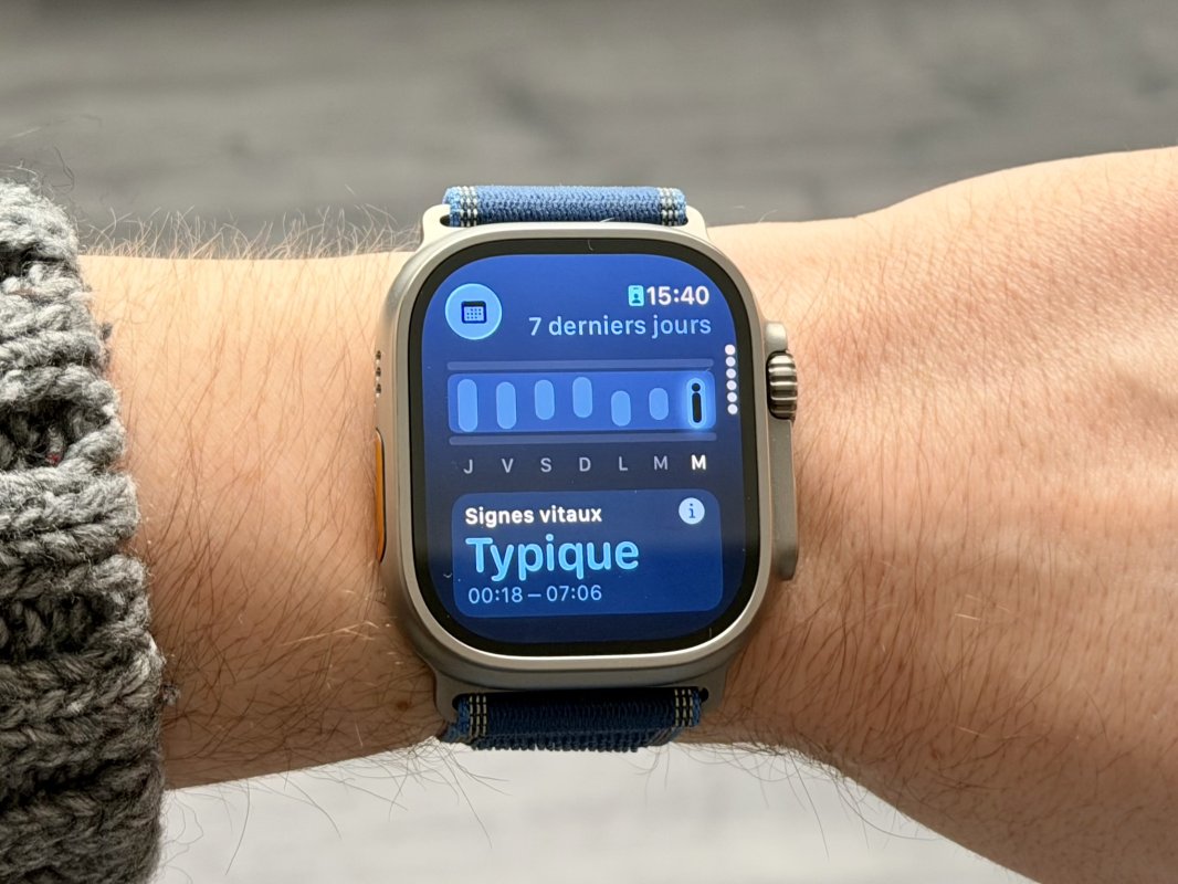 Capteur de glycémie sur l'Apple Watch : un changement de direction encourageant