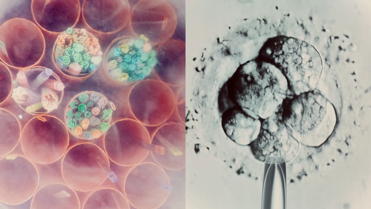 The Download: mimicking pregnancy’s first moments in a lab, and AI parameters explained