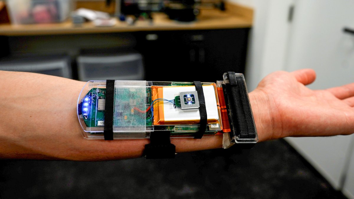 Ultrasound imaging turns a robot hand into a skillful mimic